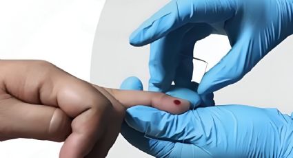 ¿Sientes fiebre, dolor de cabeza, sudoración o escalofríos? Podrías tener paludismo, esto debes hacer