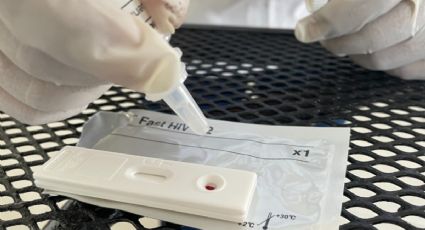 Dónde hacerse la prueba del VIH gratis en Quintana Roo